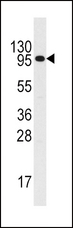 CSF2RB / CD131 Antibody - Western blot of anti-IL3R antibody (RB06990) in HL60 cell line lysates (35 ug/lane). IL3R (arrow) was detected using the purified antibody.