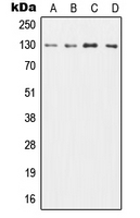 CSF2RB / CD131 Antibody - Western blot analysis of CD131 expression in HL60 (A); TF1 (B); SP2/0 (C); H9C2 (D) whole cell lysates.