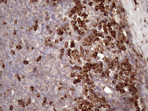 CSF2RB / CD131 Antibody - Immunohistochemical staining of paraffin-embedded Human tonsil within the normal limits using anti-CSF2RB mouse monoclonal antibody. (Heat-induced epitope retrieval by 1mM EDTA in 10mM Tris buffer. (pH8.5) at 120 oC for 3 min. (1:150)