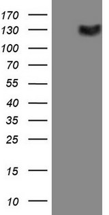 CSF2RB / CD131 Antibody - HEK293T cells were transfected with the pCMV6-ENTRY control. (Left lane) or pCMV6-ENTRY CSF2RB. (Right lane) cDNA for 48 hrs and lysed. Equivalent amounts of cell lysates. (5 ug per lane) were separated by SDS-PAGE and immunoblotted with anti-CSF2RB. (1:2000)