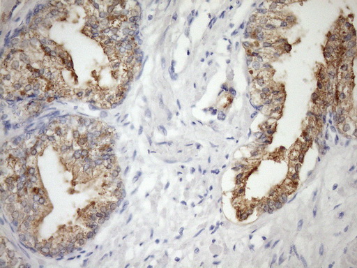 CSF2RB / CD131 Antibody - Immunohistochemical staining of paraffin-embedded Human prostate tissue within the normal limits using anti-CSF2RB mouse monoclonal antibody. (Heat-induced epitope retrieval by Tris-EDTA, pH8.0)(1:150)