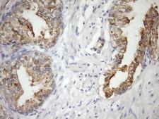 CSF2RB / CD131 Antibody - Immunohistochemical staining of paraffin-embedded Human prostate tissue within the normal limits using anti-CSF2RB mouse monoclonal antibody. (Heat-induced epitope retrieval by Tris-EDTA, pH8.0)(1:150)