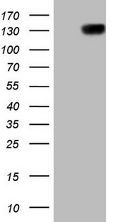 CSF2RB / CD131 Antibody - HEK293T cells were transfected with the pCMV6-ENTRY control (Left lane) or pCMV6-ENTRY CSF2RB (Right lane) cDNA for 48 hrs and lysed. Equivalent amounts of cell lysates (5 ug per lane) were separated by SDS-PAGE and immunoblotted with anti-CSF2RB (1:2000).