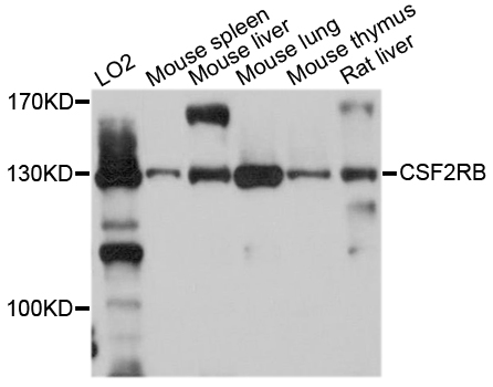 CSF2RB / CD131 Antibody - Western blot analysis of extracts of various cell lines, using CSF2RB antibody at 1:1000 dilution. The secondary antibody used was an HRP Goat Anti-Rabbit IgG (H+L) at 1:10000 dilution. Lysates were loaded 25ug per lane and 3% nonfat dry milk in TBST was used for blocking. An ECL Kit was used for detection and the exposure time was 10s.