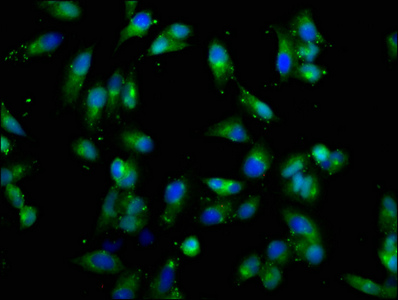 CSF2RB / CD131 Antibody - Immunofluorescence staining of Hela cells with CSF2RB Antibody at 1:66, counter-stained with DAPI. The cells were fixed in 4% formaldehyde, permeabilized using 0.2% Triton X-100 and blocked in 10% normal Goat Serum. The cells were then incubated with the antibody overnight at 4°C. The secondary antibody was Alexa Fluor 488-congugated AffiniPure Goat Anti-Rabbit IgG(H+L).