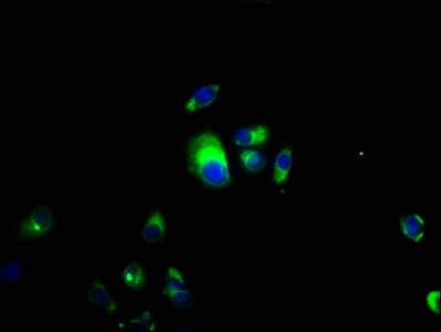 CSF2RB / CD131 Antibody - Immunofluorescence staining of MCF-7 cells with CSF2RB Antibody at 1:66, counter-stained with DAPI. The cells were fixed in 4% formaldehyde, permeabilized using 0.2% Triton X-100 and blocked in 10% normal Goat Serum. The cells were then incubated with the antibody overnight at 4°C. The secondary antibody was Alexa Fluor 488-congugated AffiniPure Goat Anti-Rabbit IgG(H+L).