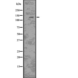 CSF2RB / CD131 Antibody - Western blot analysis of CSF2RB using Jurkat whole lysates.