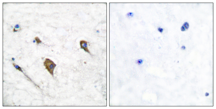 CSF2RB / CD131 Antibody - Immunohistochemistry analysis of paraffin-embedded human brain, using IL-3R beta (Phospho-Tyr593) Antibody. The picture on the right is blocked with the phospho peptide.