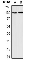 CSF2RB / CD131 Antibody - Western blot analysis of CD131 (pY593) expression in MCF7 IL1b-treated (A); HepG2 LPS-treated (B) whole cell lysates.