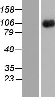 CSF2RB / CD131 Protein - Western validation with an anti-DDK antibody * L: Control HEK293 lysate R: Over-expression lysate