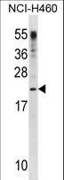 CSF3 / G-CSF Antibody - CSF3 Antibody western blot of NCI-H460 cell line lysates (35 ug/lane). The CSF3 antibody detected the CSF3 protein (arrow).