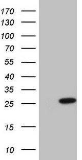 CSF3 / G-CSF Antibody - HEK293T cells were transfected with the pCMV6-ENTRY control (Left lane) or pCMV6-ENTRY CSF3 (Right lane) cDNA for 48 hrs and lysed. Equivalent amounts of cell lysates (5 ug per lane) were separated by SDS-PAGE and immunoblotted with anti-CSF3 (1:2000).