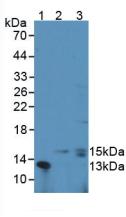CSF3 / G-CSF Antibody - Western Blot; Sample: Lane1:Mouse Lymphocyte Cells; Lane2: Human Leukocyte Cells; Lane3: Mouse Thymus Tissue.