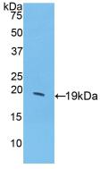 CSF3 / G-CSF Antibody - Western Blot; Sample: Recombinant GCSF, Porcine.