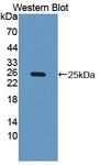 CSF3 / G-CSF Antibody - Western blot of CSF3 / G-CSF antibody.