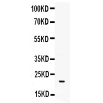 CSF3 / G-CSF Antibody - G-CSF antibody Western blot. All lanes: Anti G-CSF at 0.5 ug/ml. WB: K562 Whole Cell Lysate at 40 ug. Predicted band size: 22 kD. Observed band size: 22 kD.