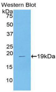 CSF3 / G-CSF Antibody - Western blot of recombinant CSF3 / G-CSF / GCSF.  This image was taken for the unconjugated form of this product. Other forms have not been tested.