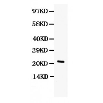 CSF3 / G-CSF Antibody - G-CSF antibody Western blot. All lanes: Anti G-CSF at 0.5 ug/ml. WB: HELA Whole Cell Lysate at 40 ug. Predicted band size: 22 kD. Observed band size: 22 kD.
