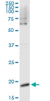 CSF3 / G-CSF Antibody - Immunoprecipitation of CSF3 transfected lysate using anti-CSF3 monoclonal antibody and Protein A Magnetic Bead, and immunoblotted with CSF3 rabbit polyclonal antibody.