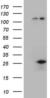 CSF3 / G-CSF Antibody - HEK293T cells were transfected with the pCMV6-ENTRY control. (Left lane) or pCMV6-ENTRY CSF3. (Right lane) cDNA for 48 hrs and lysed. Equivalent amounts of cell lysates. (5 ug per lane) were separated by SDS-PAGE and immunoblotted with anti-CSF3. (1:2000)