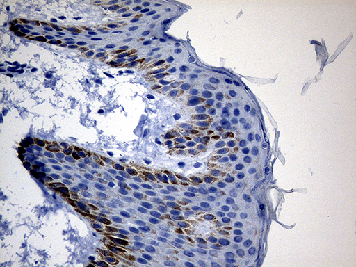 CSF3 / G-CSF Antibody - Immunohistochemical staining of paraffin-embedded Human skin tissue within the normal limits using anti-CSF3 mouse monoclonal antibody. (Heat-induced epitope retrieval by 1mM EDTA in 10mM Tris buffer. (pH8.5) at 120 oC for 3 min. (1:500)
