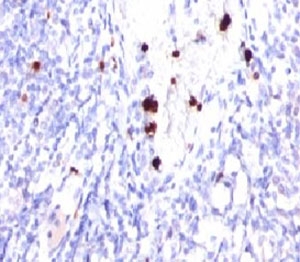 CSF3 / G-CSF Antibody - IHC testing of FFPE human tonsil and G-CSF antibody (PRPN2-1). Note cytoplasmic staining of granulocytes.  This image was taken for the unmodified form of this product. Other forms have not been tested.