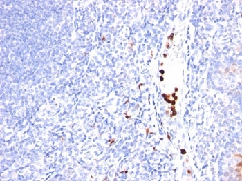 CSF3 / G-CSF Antibody - Formalin-fixed, paraffin-embedded human tonsil stained with GCSF antibody (SPM468).  This image was taken for the unmodified form of this product. Other forms have not been tested.