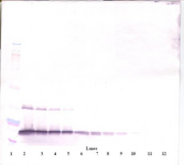 CSF3 / G-CSF Antibody - Anti-Human G-CSF Western Blot Reduced