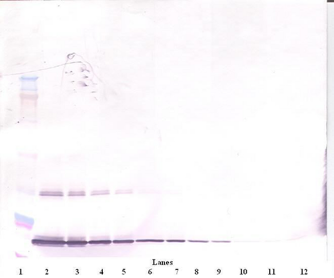 CSF3 / G-CSF Antibody - Anti-Human G-CSF Western Blot Unreduced