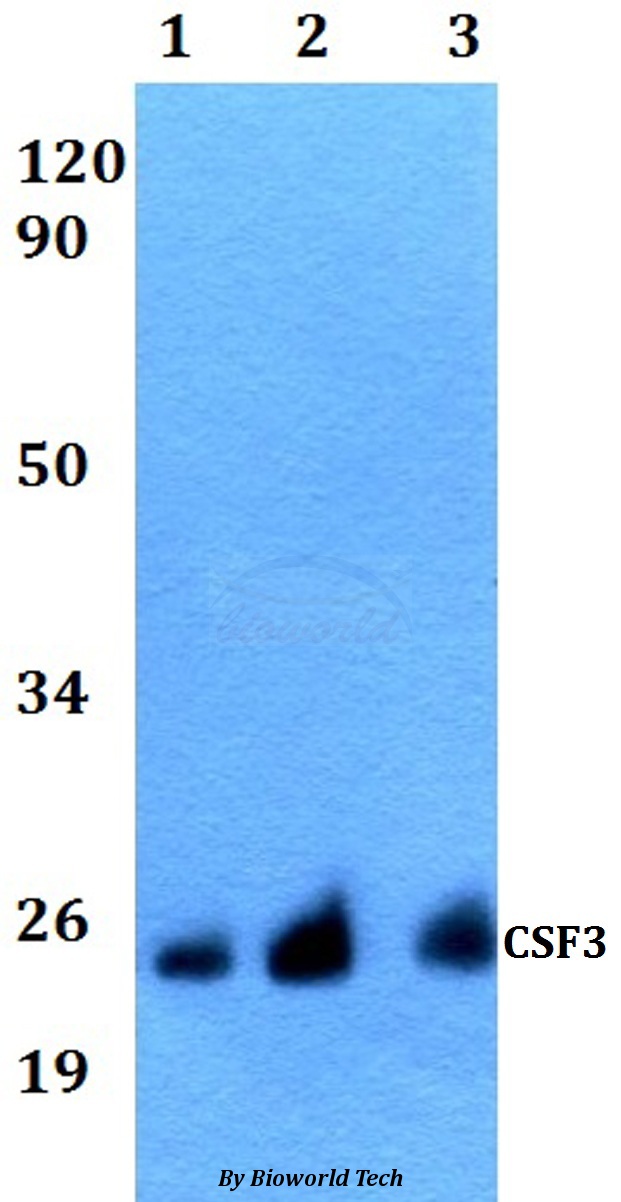 CSF3 / G-CSF Antibody - Western blot of CSF3 antibody at 1:500 dilution. Lane 1: HeLa whole cell lysate. Lane 2: Raw264.7 whole cell lysate. Lane 3: PC12 whole cell lysate.