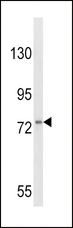 CSF3R / CD114 Antibody - Western blot of CSF3R Antibody in HL-60 cell line lysates (35 ug/lane). CSF3R (arrow) was detected using the purified antibody.