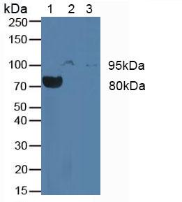 CSF3R / CD114 Antibody - Western Blot; Sample: Lane1: Rat Blood Cells; Lane2: Human JAR Cells; Lane3: Human Placenta Tissue.