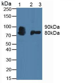 CSF3R / CD114 Antibody - Western Blot; Sample: Lane1: Human Blood Cells; Lane2: Rat Placenta Tissue; Lane3: MousePlacenta Tissue.