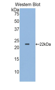 CSF3R / CD114 Antibody - Western blot of recombinant CSF3R / CD114.  This image was taken for the unconjugated form of this product. Other forms have not been tested.