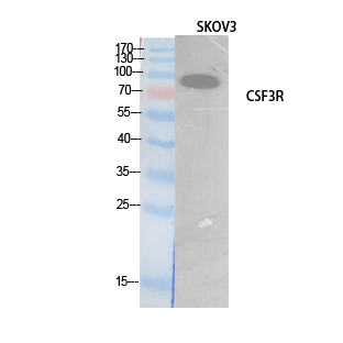 CSF3R / CD114 Antibody - Western Blot analysis of extracts from SKOV3 cells using CSF3R Antibody.