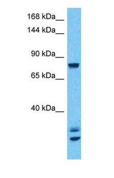 CSF3R / CD114 Antibody - Western blot of CSF3R Antibody with human 293T Whole Cell lysate.  This image was taken for the unconjugated form of this product. Other forms have not been tested.