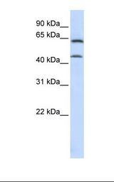 CSGALNACT1 Antibody - MCF7 cell lysate. Antibody concentration: 1.0 ug/ml. Gel concentration: 12%.  This image was taken for the unconjugated form of this product. Other forms have not been tested.