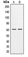 CSGALNACT1 Antibody - Western blot analysis of CSGALNACT1 expression in MCF7 (A); K562 (B) whole cell lysates.
