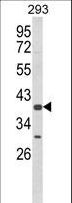CSGALNACT2 Antibody - Western blot of CSGALNACT2 Antibody in 293 cell line lysates (35 ug/lane). CSGALNACT2 (arrow) was detected using the purified antibody.