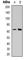 CSGALNACT2 Antibody - Western blot analysis of CSGALNACT2 expression in K562 (A); Jurkat (B) whole cell lysates.