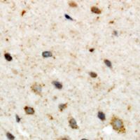 CSGALNACT2 Antibody - Immunohistochemical analysis of CSGALNACT2 staining in human brain formalin fixed paraffin embedded tissue section. The section was pre-treated using heat mediated antigen retrieval with sodium citrate buffer (pH 6.0). The section was then incubated with the antibody at room temperature and detected using an HRP polymer system. DAB was used as the chromogen. The section was then counterstained with hematoxylin and mounted with DPX.