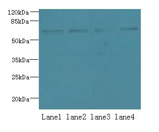 CSGALNACT2 Antibody - Western blot. All lanes: CSGALNACT2 antibody at 4 ug/ml. Lane 1: K562 whole cell lysate. Lane 2: 293T whole cell lysate. Lane 3: Jurkat whole cell lysate. Lane 4: PC-3 whole cell lysate. Secondary Goat polyclonal to Rabbit IgG at 1:10000 dilution. Predicted band size: 63 kDa. Observed band size: 63 kDa.