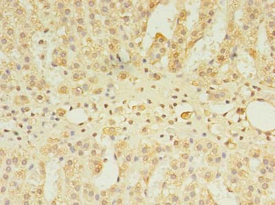 CSGALNACT2 Antibody - Immunohistochemistry of paraffin-embedded human adrenal gland tissue using antibody at dilution of 1:100.
