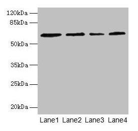 CSGALNACT2 Antibody - Western blot All lanes: CSGALNACT2 antibody at 4µg/ml Lane 1: K562 whole cell lysate Lane 2: 293T whole cell lysate Lane 3: Jurkat whole cell lysate Lane 4: PC-3 whole cell lysate Secondary Goat polyclonal to rabbit IgG at 1/10000 dilution Predicted band size: 63, 39 kDa Observed band size: 63 kDa