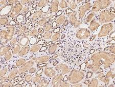 CSGALNACT2 Antibody - Immunochemical staining of human CSGALNACT2 in human kidney with rabbit polyclonal antibody at 1:100 dilution, formalin-fixed paraffin embedded sections.