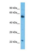 CSGALNACT2 Antibody - Western blot of CGAT2 Antibody with human HepG2 Whole Cell lysate.  This image was taken for the unconjugated form of this product. Other forms have not been tested.