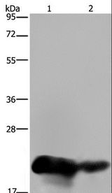 CSH1 / Placental Lactogen Antibody - Western blot analysis of Human placenta and breast infiltrative duct tissue, using CSH1 Polyclonal Antibody at dilution of 1:200.