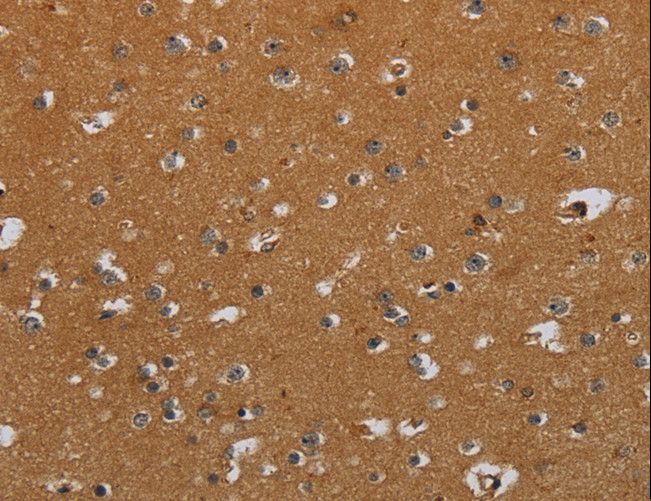 CSH1 / Placental Lactogen Antibody - Immunohistochemistry of paraffin-embedded Human brain using CSH1 Polyclonal Antibody at dilution of 1:40.