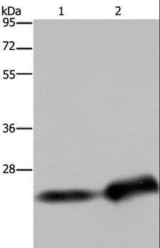 CSH1 / Placental Lactogen Antibody - Western blot analysis of Human breast infiltrative duct and placenta tissue, using CSH1 Polyclonal Antibody at dilution of 1:300.