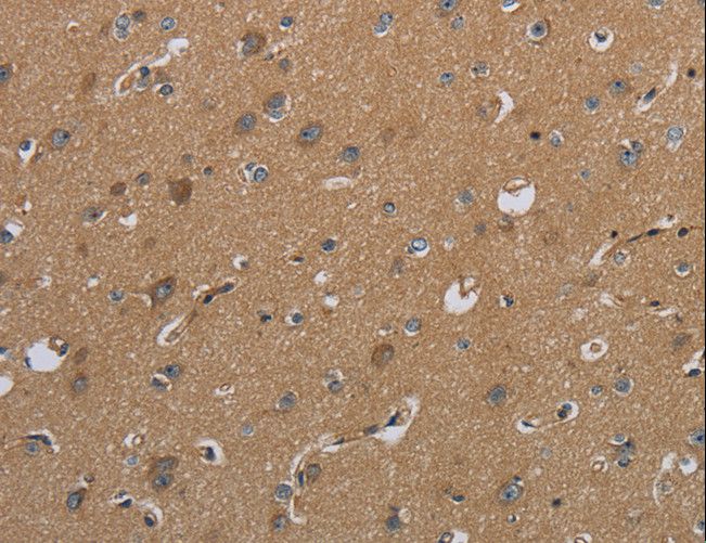 CSH1 / Placental Lactogen Antibody - Immunohistochemistry of paraffin-embedded Human brain using CSH1 Polyclonal Antibody at dilution of 1:50.